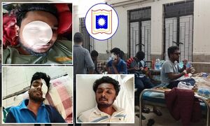 কেমন আছেন চোখ হারাতে বসা রাবির তিন শিক্ষার্থী