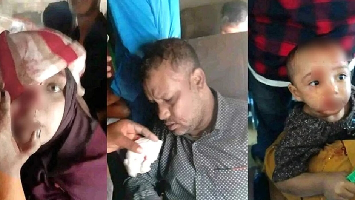 শিক্ষার্থীদের হামলায় আহত নারী-শিশুসহ অনেক যাত্রী