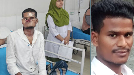 আন্দোলনে গুলিতে মুখের অবয়ব হারানো সেই খোকনকে পাঠানো হচ্ছে রাশিয়ায়